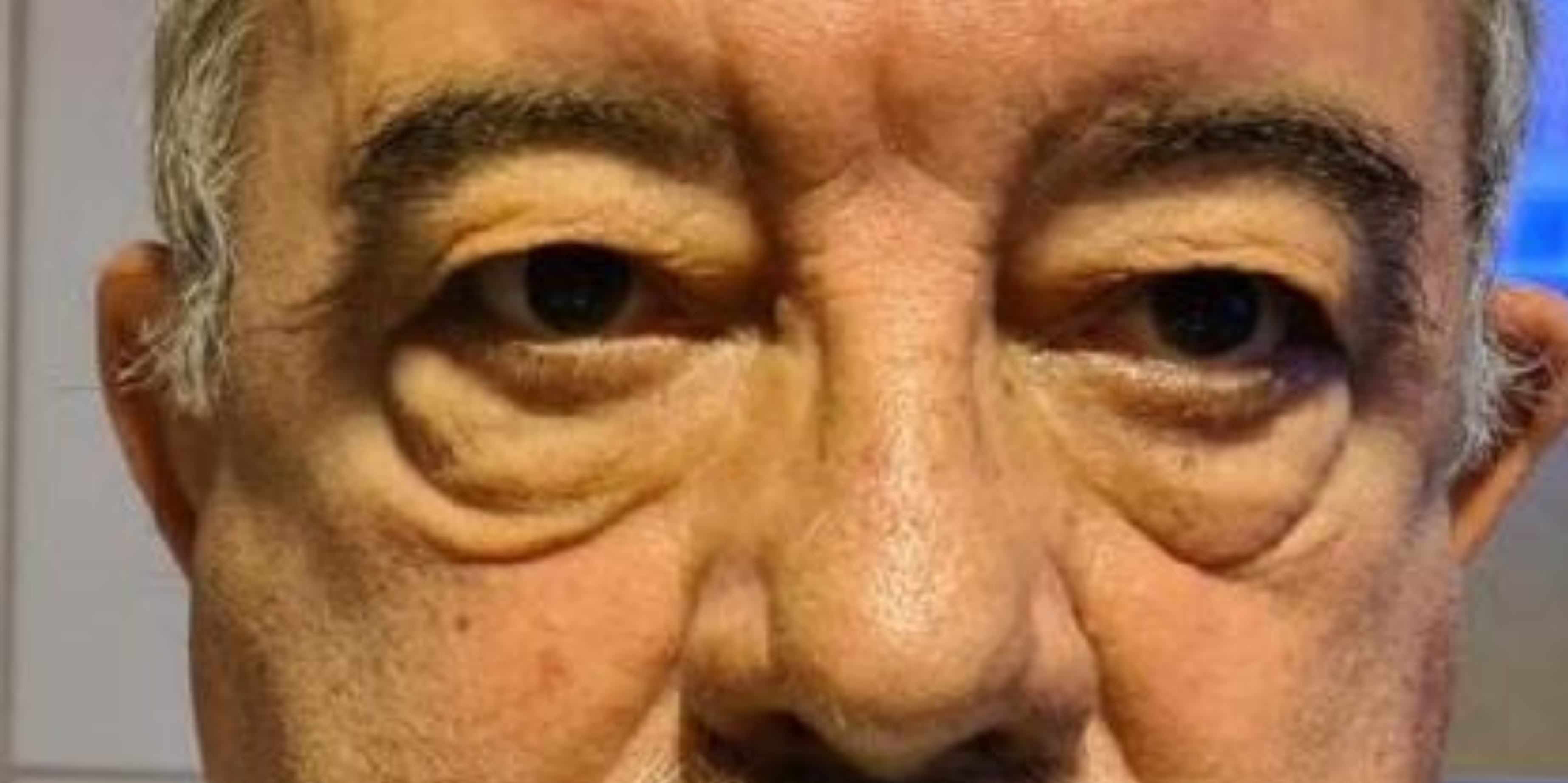 Antes do procedimento